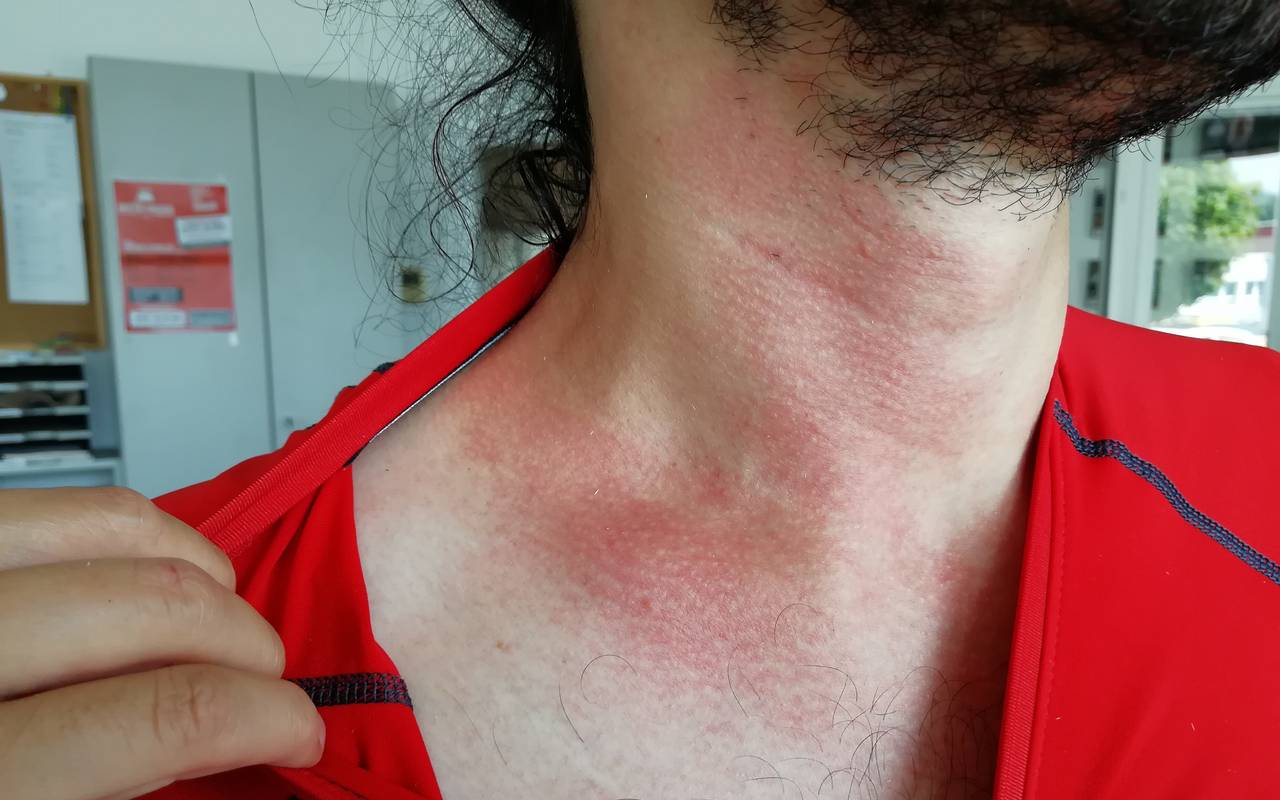 Kampf Den Raupen Ne Ws 89 4